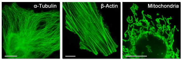 subcellular localization